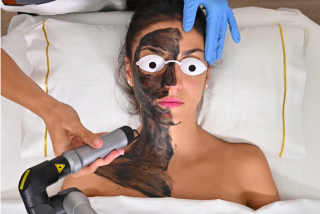 Maribel Yebenes Thermage escote