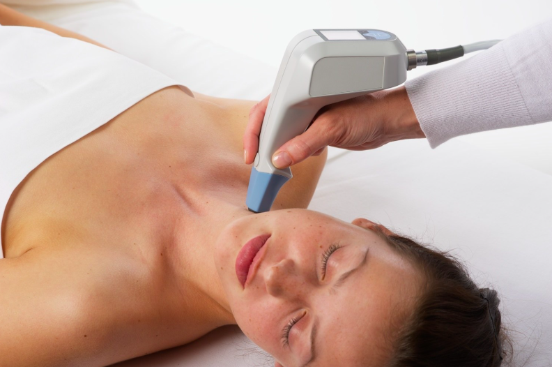 Exilis facial