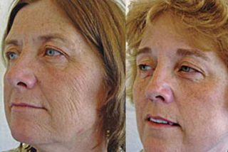 &iquest;Qui&eacute;n es la fumadora?