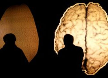 Pacientes en estado m&iacute;nimamente consciente podr&iacute;an sentir dolor