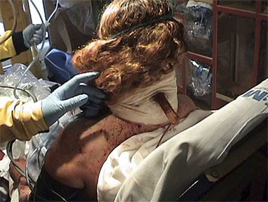 Una mujer sobrevive tras recibir una pu&ntilde;alada en el cuello con un cuchillo de cocina