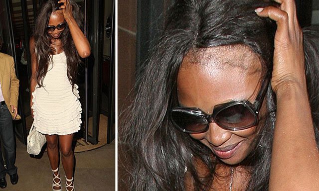 Naomi, cada vez más calva