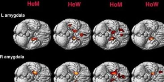 Los gays tienen un cerebro feminizado y las lesbianas varonil