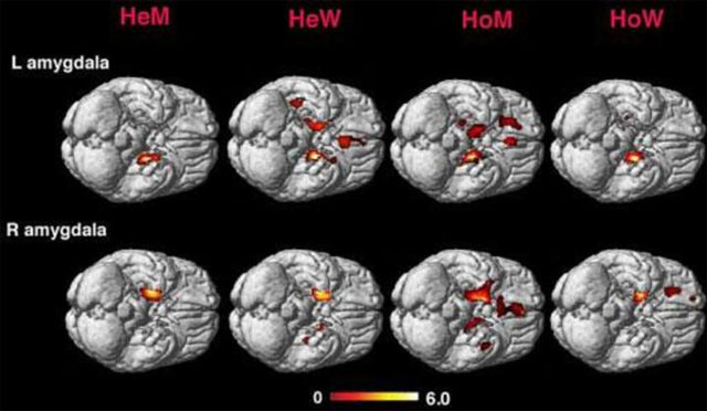 El cerebro de los gays es similar al de las mujeres