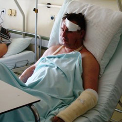 Tremenda paliza a un periodista por informar sobre la mafia en Croacia