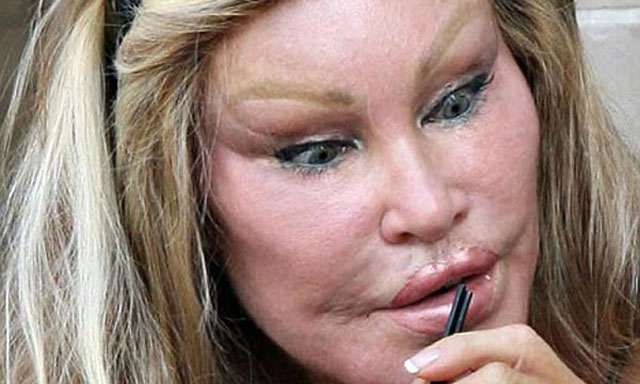 La "mujer gato", peor que nunca