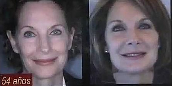 Diez a&ntilde;os m&aacute;s joven con la grasa de tu barriga