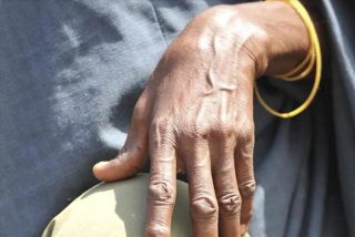 El Papa, Alemania y Somalia