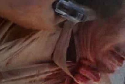 Gadafi fue sodomizado con un palo antes de ser tiroteado en el vientre