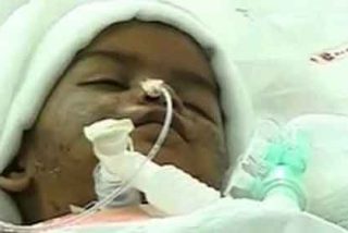 La estremecedera historia de la beb&eacute; mordida por otros seres humanos