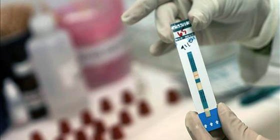 La píldora única contra el VIH reduce las hospitalizaciones un 25%