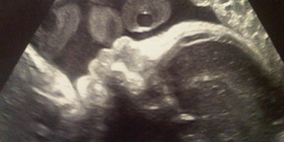 Gerard Piqué comparte una ecografía de su hijo