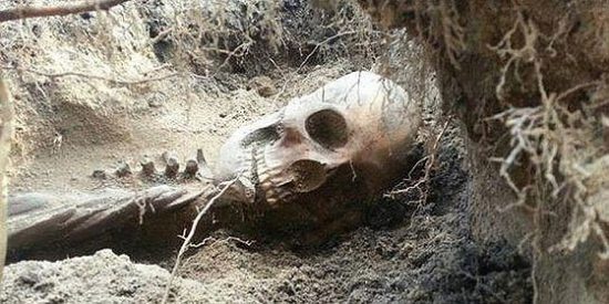 El 50% de la clase trabajadora medieval sufri&oacute; fracturas &oacute;seas