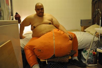 Muere el hombre al que se le hincharon los test&iacute;culos hasta pesarle 63 kilos por haberse sentado encima