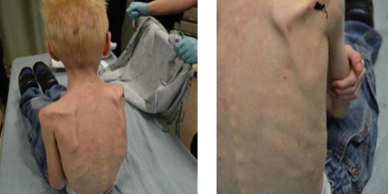 Meten a su hijo de 5 años en un armario a tortas y lo dejan muriéndose de hambre