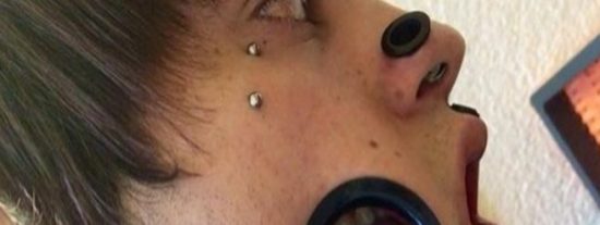 Un joven se opera para poder comer por la mejilla y se divide la lengua como un reptil