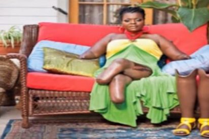 Le amputan las manos y los pies por culpa de una operaci&oacute;n est&eacute;tica de juzgado de guardia