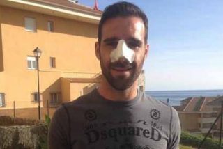 As&iacute; ha quedado G&aacute;mez tras su operaci&oacute;n de nariz