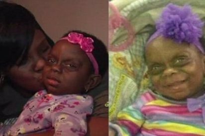 La beb&eacute; enferma que sufre burlas por una foto en Facebook: "Mi hija no es un monstruo"
