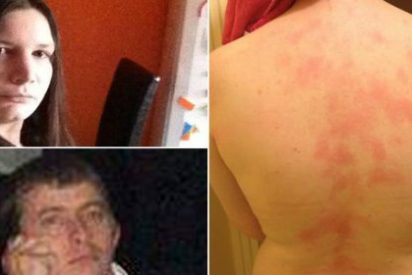 La mujer que es al&eacute;rgica a los besos del marido no se atreve ni a llorar de rabia