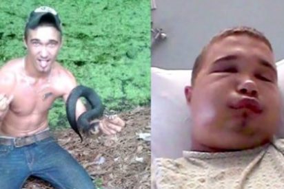 As&iacute; le ha dejado la cara a este listillo una serpiente venenosa nada besucona