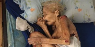 La dantesca foto de una anciana a quien su hijo y nuera han dejado morir de hambre... &iexcl;en Espa&ntilde;a!