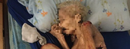 La dantesca foto de una anciana a quien su hijo y nuera han dejado morir de hambre... &iexcl;en Espa&ntilde;a!