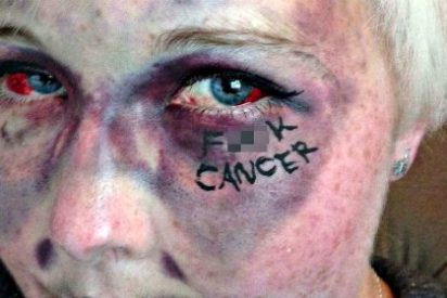 Los 12 s&iacute;ntomas que nos avisan de un c&aacute;ncer