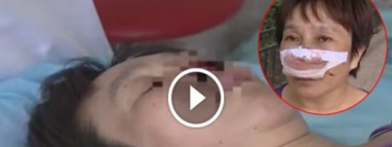[V&iacute;deo] Le arranca la nariz a su esposa de un mordisco y se la traga... por no cogerle el m&oacute;vil