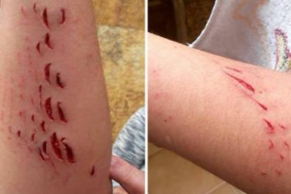 La turista madrile&ntilde;a mordida por un tibur&oacute;n en una playa de Gran Canaria