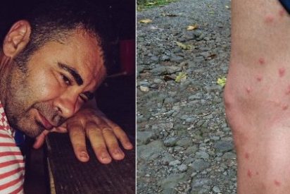 Jorge Javier Vázquez, "masacrado" por los mosquitos en su aventura con Calleja