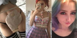 Una adolescente revela en Facebook c&oacute;mo vive con su bolsa de ileostom&iacute;a
