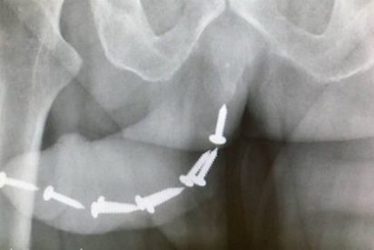 La ma&ntilde;osa cornuda mete 12 tornillos en el pene de su novio y se queda 'clavada'