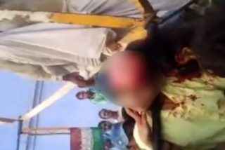 &iexcl;Horror! La chica pierde su cuero cabelludo en la feria por culpa de una selfi