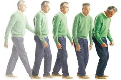 Un nuevo rayo de esperanza sobre la enfermedad de Parkinson