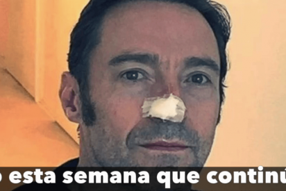 As&iacute; es el c&aacute;ncer de piel que sufre el actor Hugh Jackman