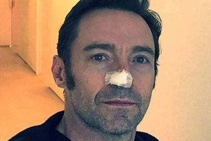 Así es el cáncer de piel que sufre el actor Hugh Jackman