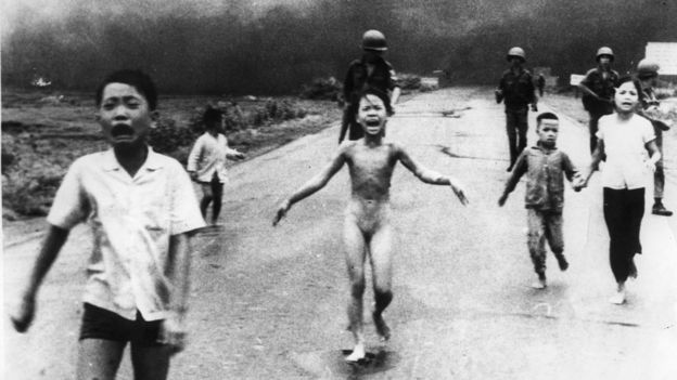 Kim Phuc, la "niña del napalm", recupera la sensibilidad en la piel con un novedoso tratamiento