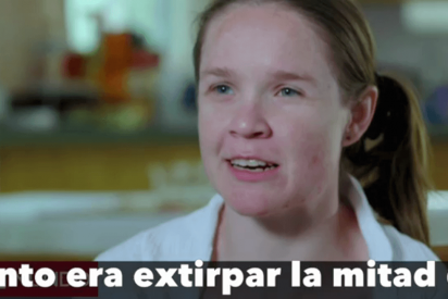 El milagroso caso de la mujer que sobrevive con medio cerebro