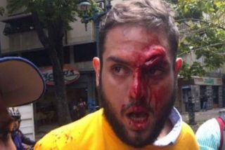As&iacute; le corta la cara con un vidrio al diputado opositor una horda chavista