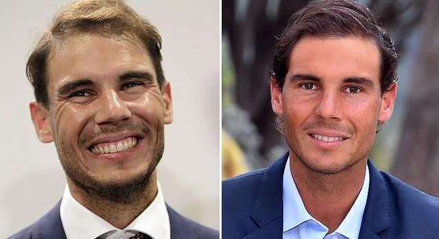 Rafa Nadal luce pelazo: los implantes capilares ya dan resultado