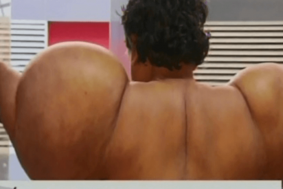 As&iacute; qued&oacute; este buzo deformado por el nitr&oacute;geno