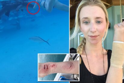Sarah Illig y el mordisco del tiburón