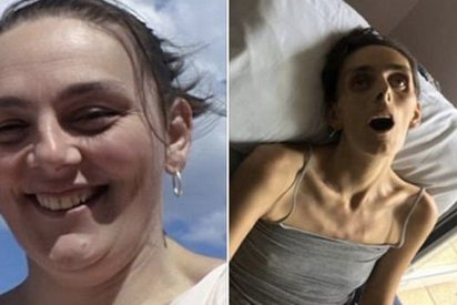 Hombre comparte crudas im&aacute;genes de su difunta esposa para concienciar a otras mujeres