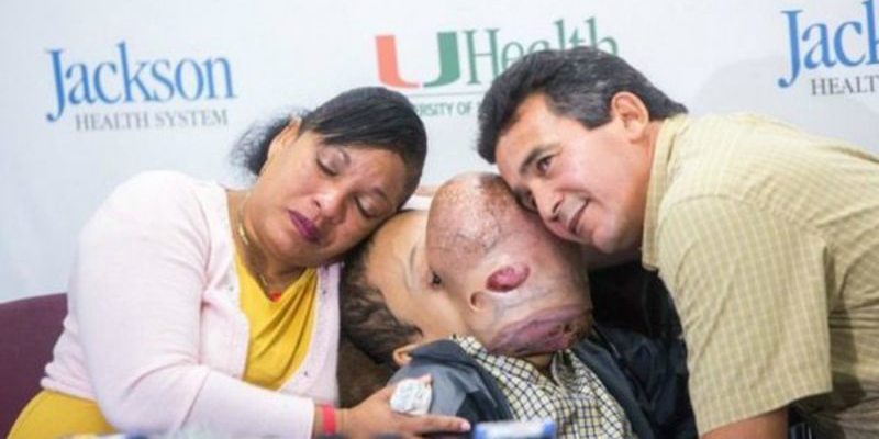 Muere Emanuel, el ni&ntilde;o cubano con un gigantesco tumor en la cara que fue operado en EEUU