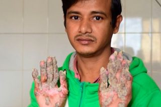 El infierno del hombre &aacute;rbol