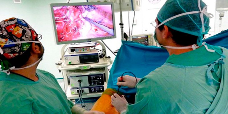 ¿Sabías que combinar cirugía con quimio y radioterapia, es mejor ante el cáncer de pulmón no mucolítico?