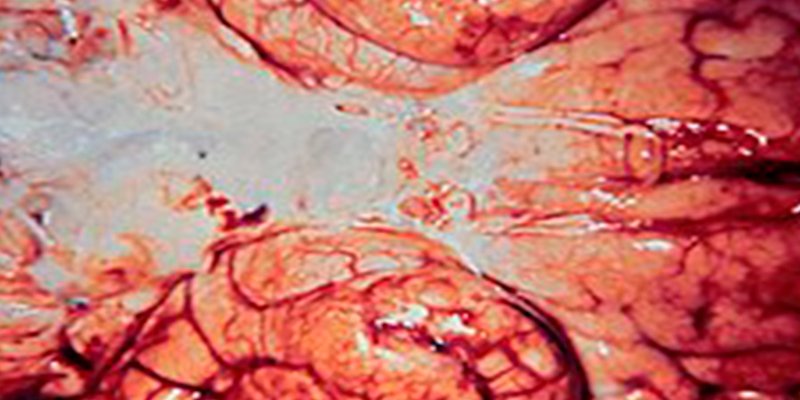 ¡OJO!: Unos quesos de leche cruda de oveja podrían ser los responsables de un caso de meningitis