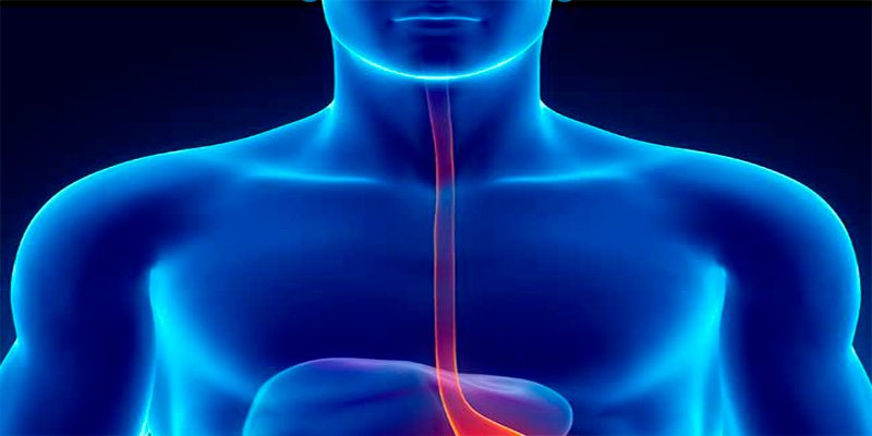 &iquest;Sabes qu&eacute; es la acalasia y c&oacute;mo se trata?
