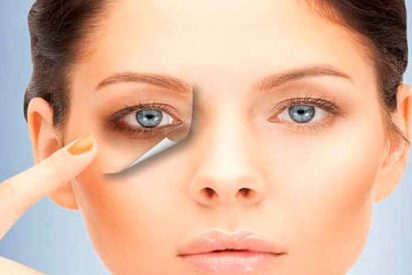 Con estos tratamientos est&eacute;ticos acabar&aacute;s con tus ojeras